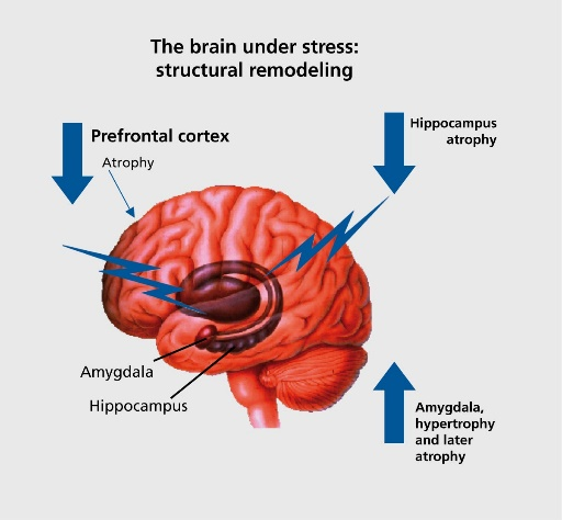"Diagram of the human brain showing how stress causes structural remodeling, including prefrontal cortex atrophy, hippocampus atrophy, and amygdala hypertrophy followed by atrophy."